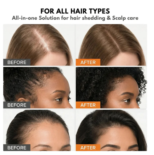 dermavine™ Grow:Turn Ampoule – Advanced Biotech Scalp & Hair Treatment