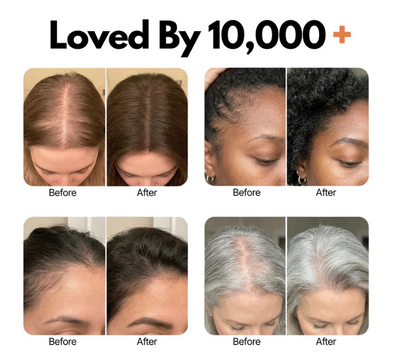 dermavine™ Grow:Turn Ampoule – Advanced Biotech Scalp & Hair Treatment