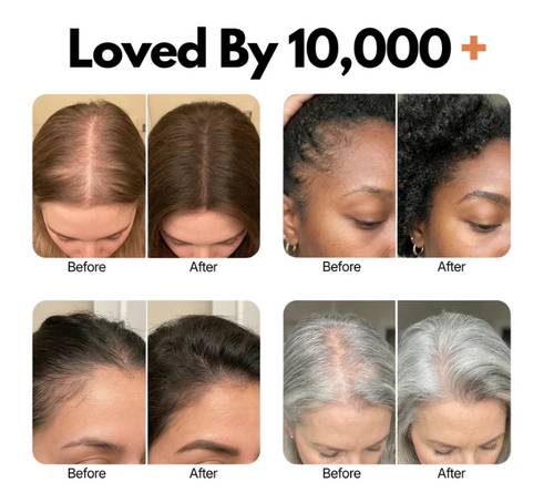 dermavine™ Grow:Turn Ampoule – Advanced Biotech Scalp & Hair Treatment