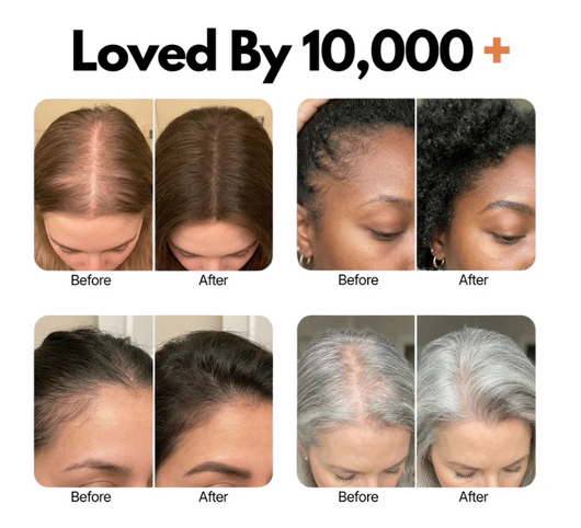 dermavine™ Grow:Turn Ampoule – Advanced Biotech Scalp & Hair Treatment